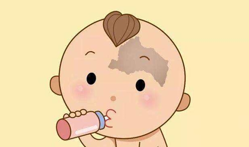 儿童太田痣